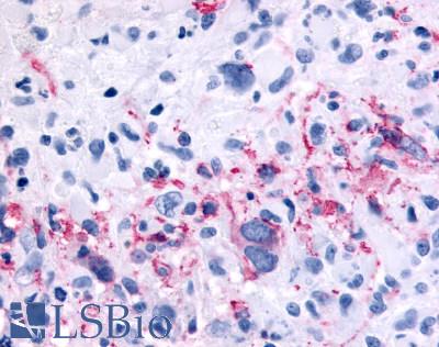 GRM6 / MGLUR6 Antibody - Brain, glioblastoma
