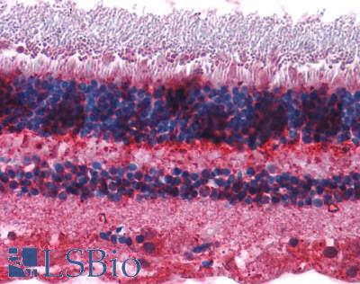 GRM7 / MGLUR7 Antibody - Eye, Retina