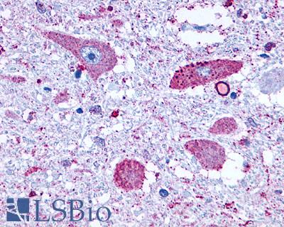GRM8 / MGLUR8 Antibody - Brain, Medulla