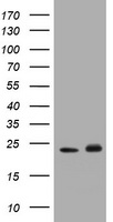 GSTP1 / GST Pi Antibody - HEK293T cells were transfected with the pCMV6-ENTRY control (Left lane) or pCMV6-ENTRY GSTP1 (Right lane) cDNA for 48 hrs and lysed. Equivalent amounts of cell lysates (5 ug per lane) were separated by SDS-PAGE and immunoblotted with anti-GSTP1.