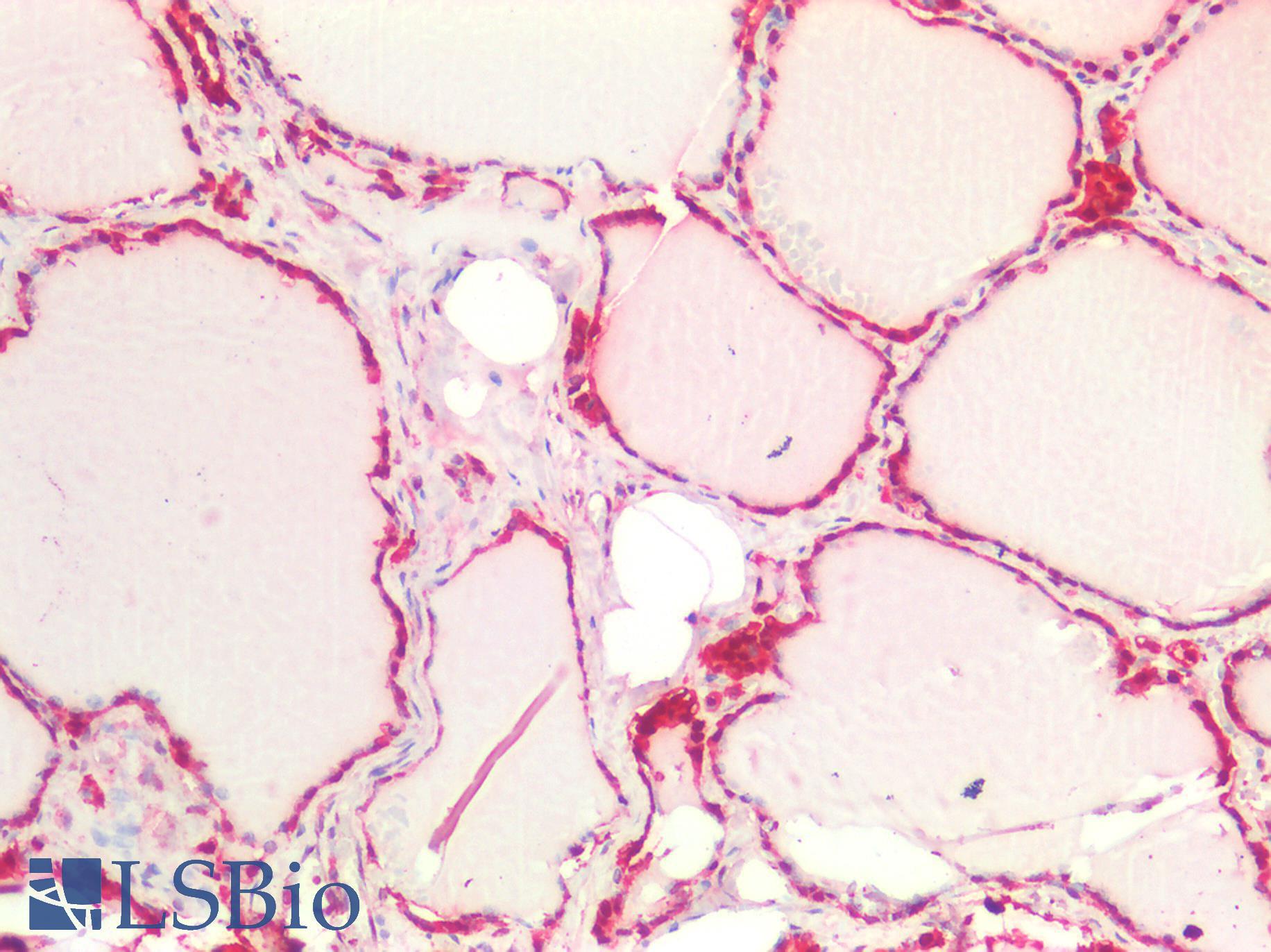 GSTP1 / GST Pi Antibody - Human Thyroid: Formalin-Fixed, Paraffin-Embedded (FFPE)