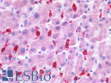 GZMB / Granzyme B Antibody - Human Liver: Formalin-Fixed, Paraffin-Embedded (FFPE)