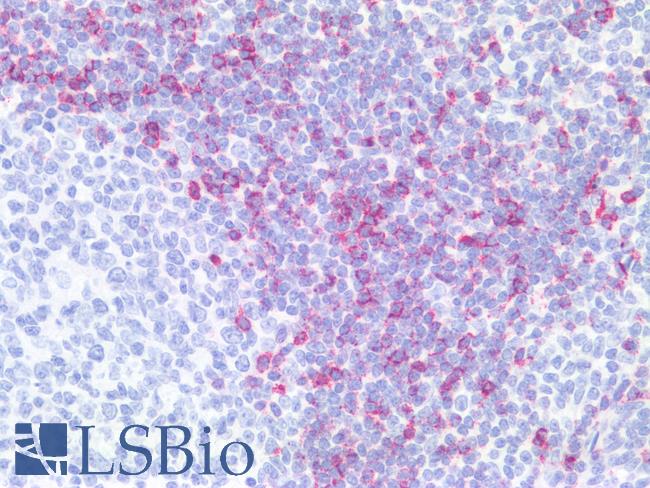 Hairy Cell Leukemia Antibody - Human Tonsil: Formalin-Fixed, Paraffin-Embedded (FFPE)