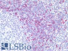 Hairy Cell Leukemia Antibody - Human Tonsil: Formalin-Fixed, Paraffin-Embedded (FFPE)