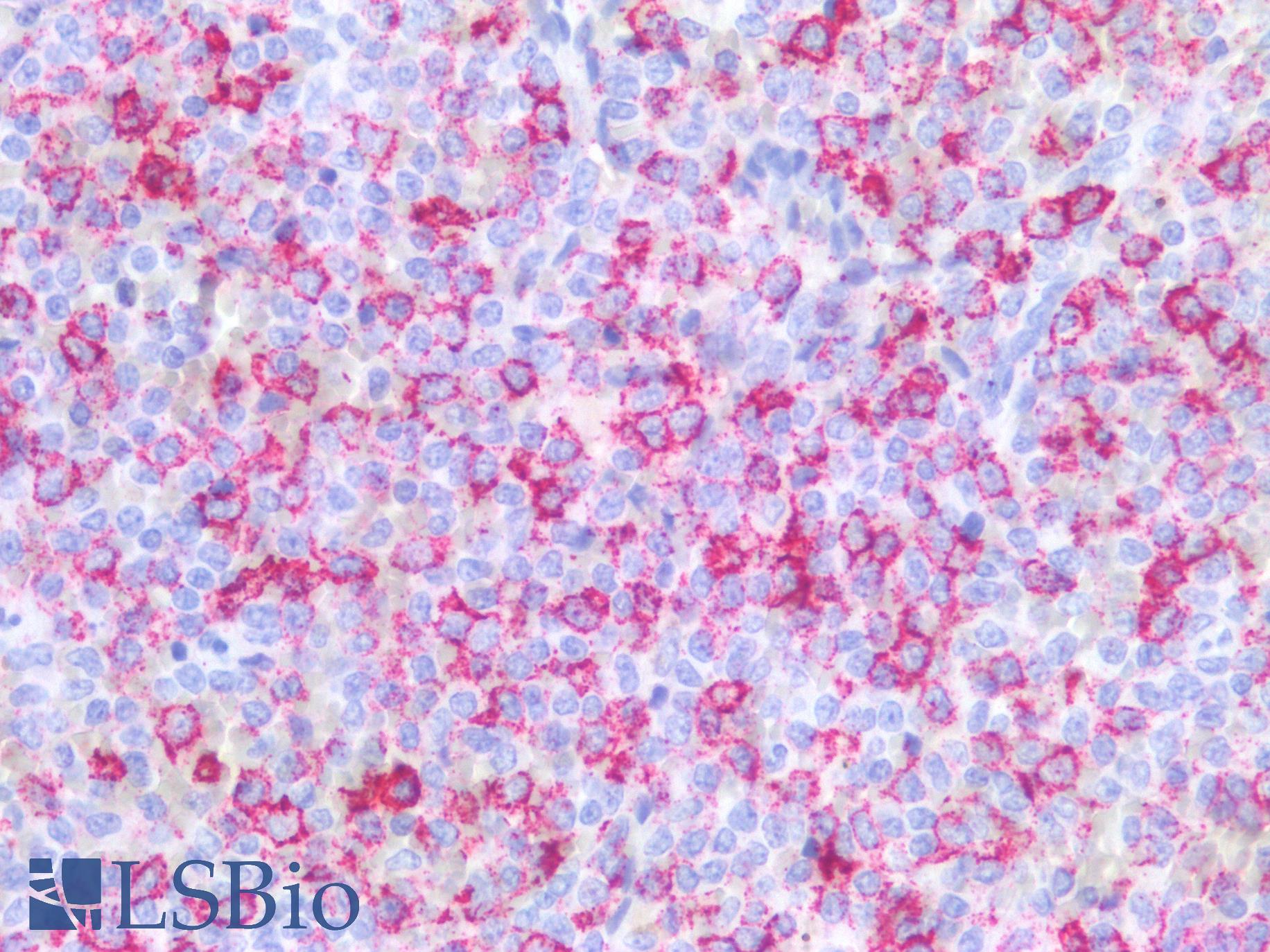 Hairy Cell Leukemia Antibody - Human Spleen: Formalin-Fixed, Paraffin-Embedded (FFPE)