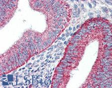 HAVCR1 / KIM-1 Antibody - Anti-TIM-1 antibody IHC of human uterus, endometrium. Immunohistochemistry of formalin-fixed, paraffin-embedded tissue after heat-induced antigen retrieval. Antibody concentration 5 ug/ml.