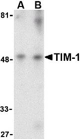 HAVCR1 / KIM-1 Antibody - Western blot of TIM-1 in human uterus tissue lysate with TIM-1 antibody at (A) 1 and (B) 2 ug/ml.