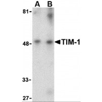 HAVCR1 / KIM-1 Antibody - Western blot analysis of TIM-1 in human uterus tissue lysate with TIM-1 antibody at (A) 1 and (B) 2 µg/mL.