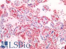 HBA2 / Hemoglobin Alpha 2 Antibody - Human Placenta: Formalin-Fixed, Paraffin-Embedded (FFPE)