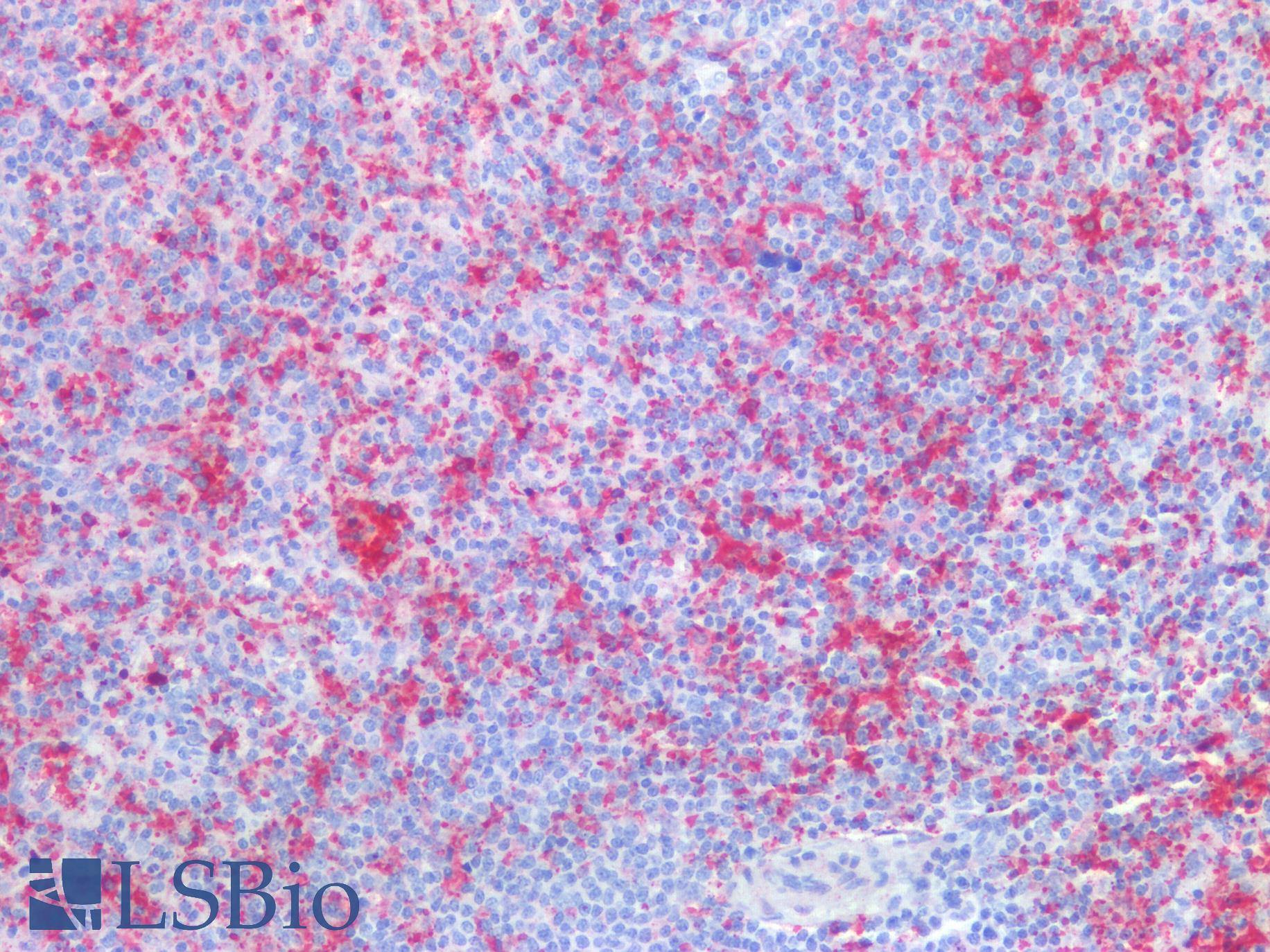 HBA2 / Hemoglobin Alpha 2 Antibody - Human Spleen: Formalin-Fixed, Paraffin-Embedded (FFPE)