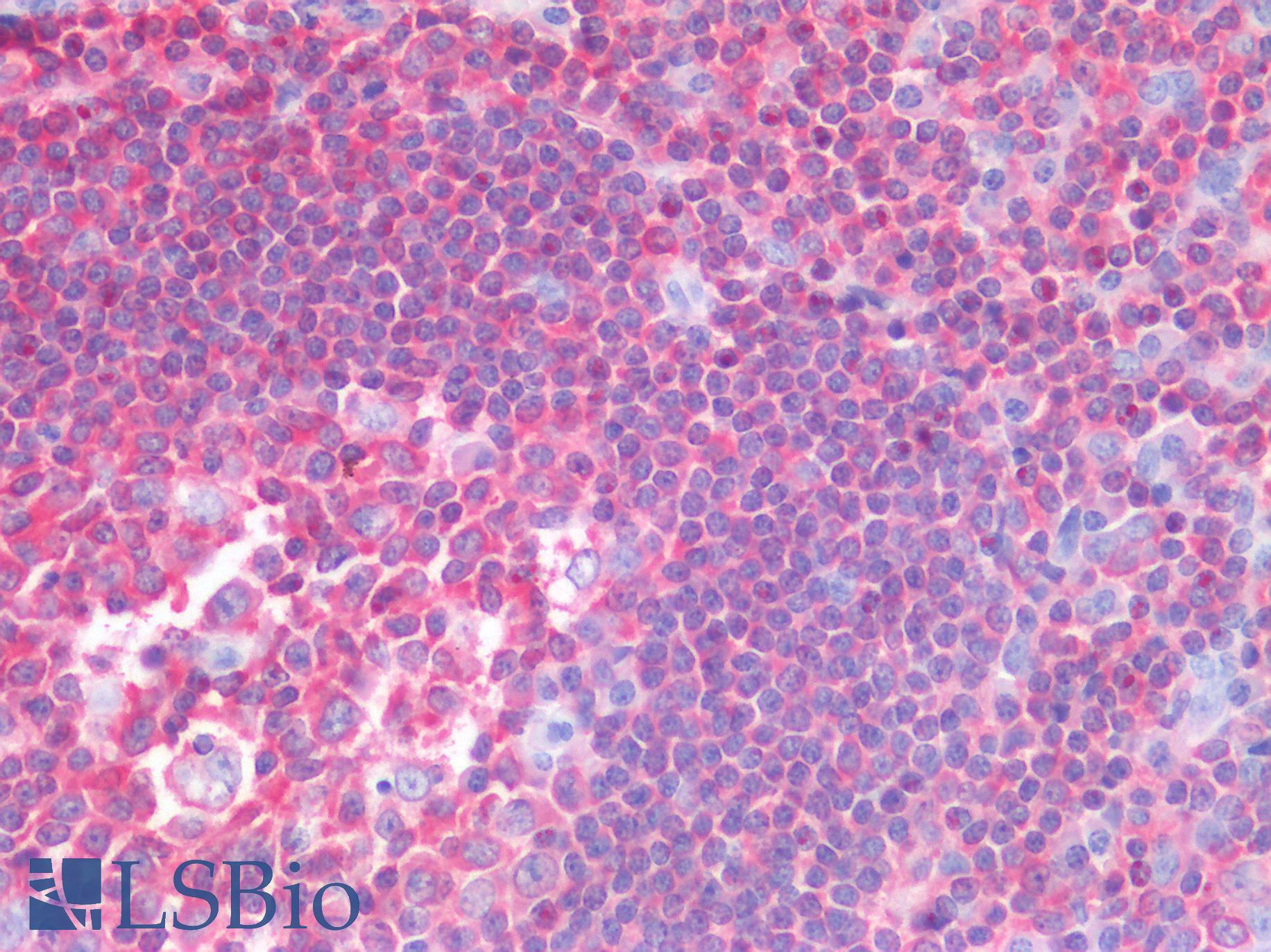 HCLS1 Antibody - Human Tonsil: Formalin-Fixed, Paraffin-Embedded (FFPE)