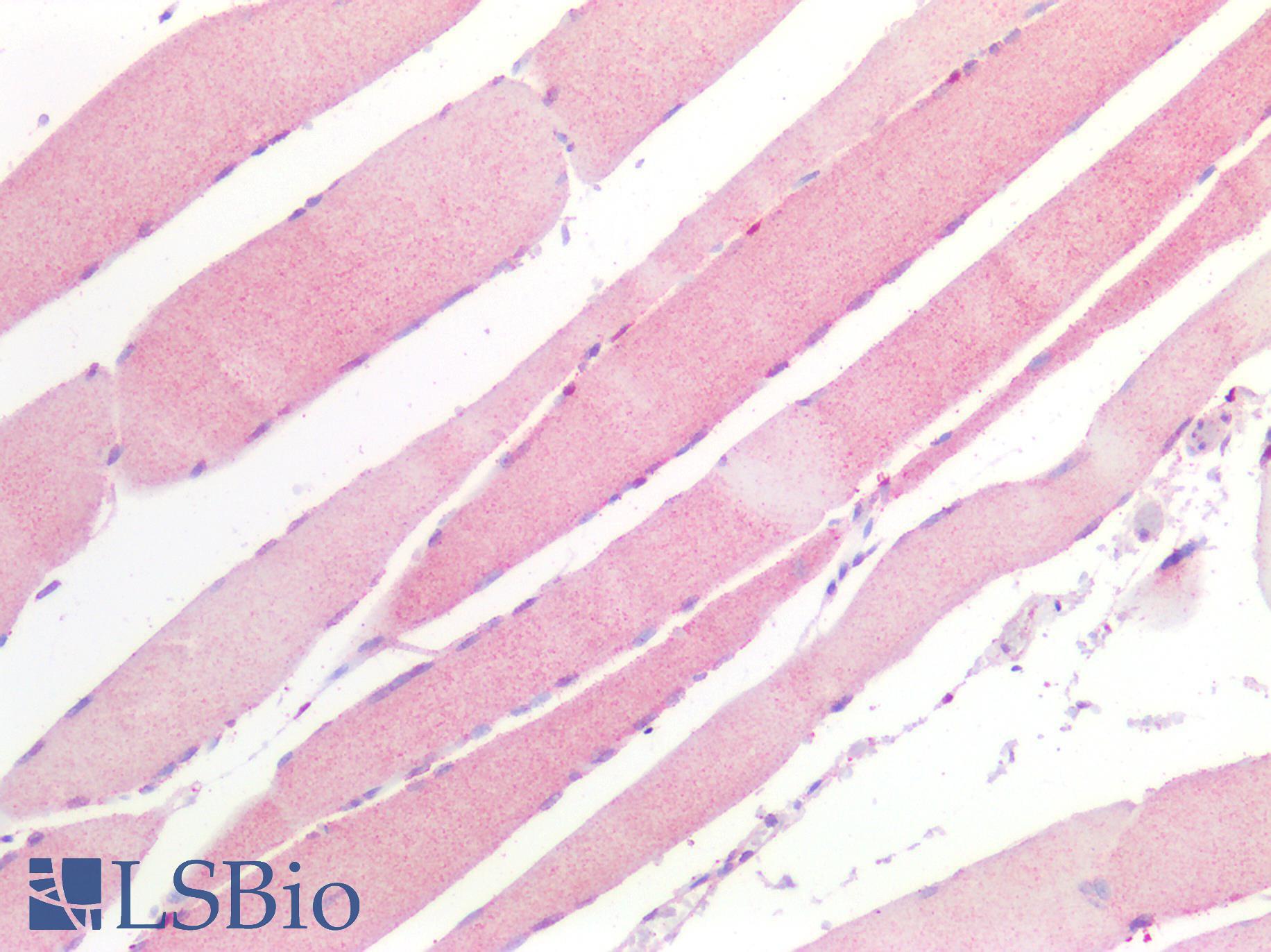 HDAC4 Antibody - Human Skeletal Muscle: Formalin-Fixed, Paraffin-Embedded (FFPE)