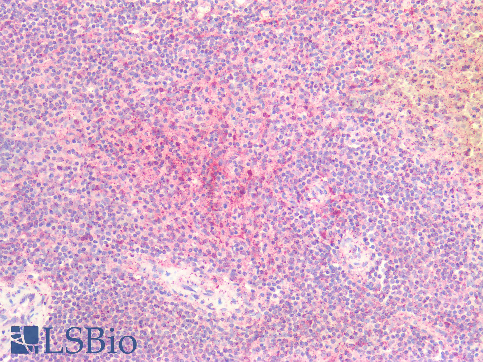 HDAC4 Antibody - Human Spleen: Formalin-Fixed, Paraffin-Embedded (FFPE)