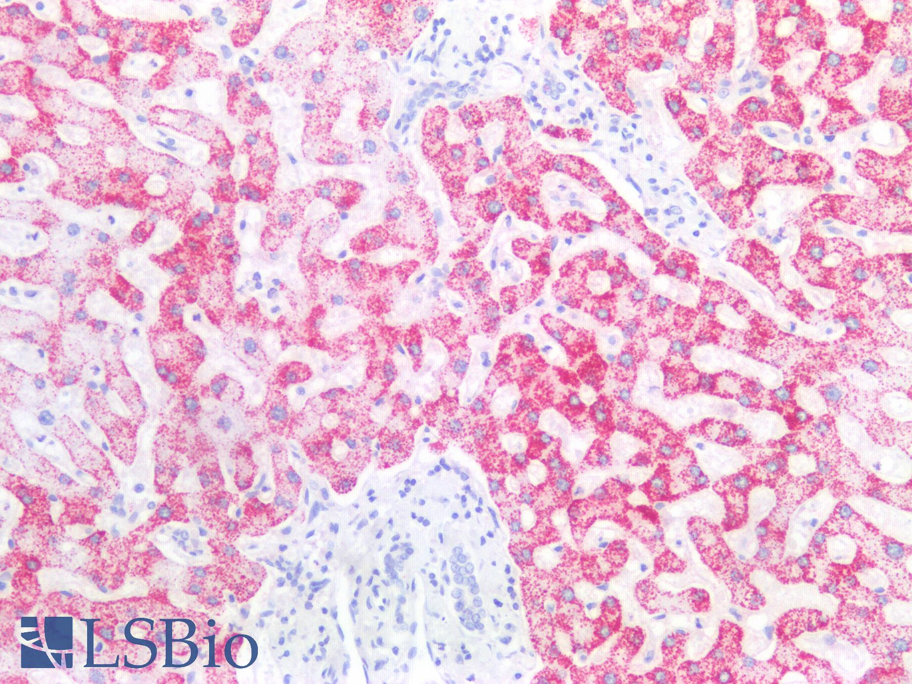 Hepatocyte Specific Antigen Antibody - Human Liver: Formalin-Fixed, Paraffin-Embedded (FFPE)