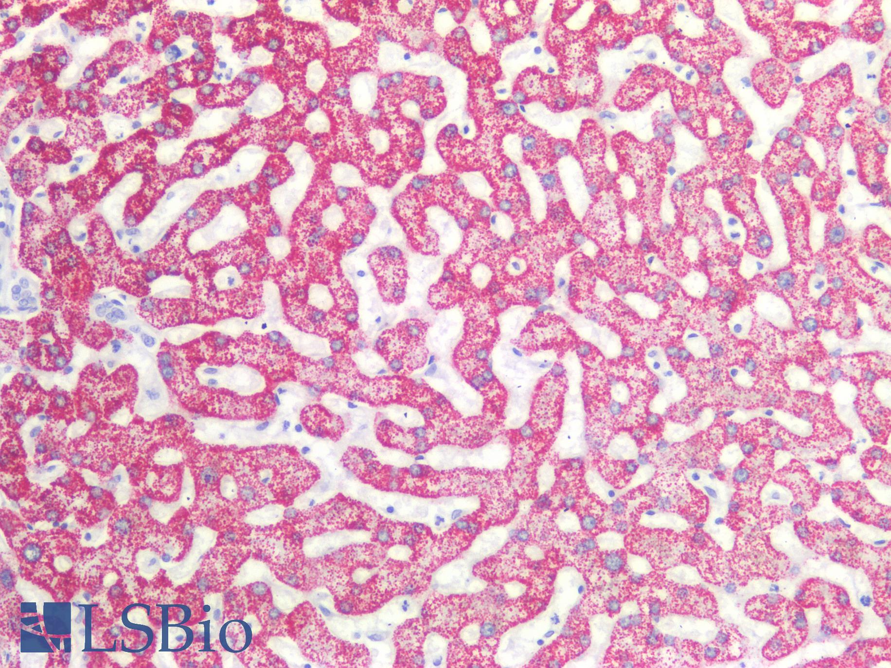 Hepatocyte Specific Antigen Antibody - Human Liver: Formalin-Fixed, Paraffin-Embedded (FFPE)