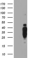 HES1 / HES-1 Antibody - HEK293T cells were transfected with the pCMV6-ENTRY control (Left lane) or pCMV6-ENTRY HES1 (Right lane) cDNA for 48 hrs and lysed. Equivalent amounts of cell lysates (5 ug per lane) were separated by SDS-PAGE and immunoblotted with anti-HES1.