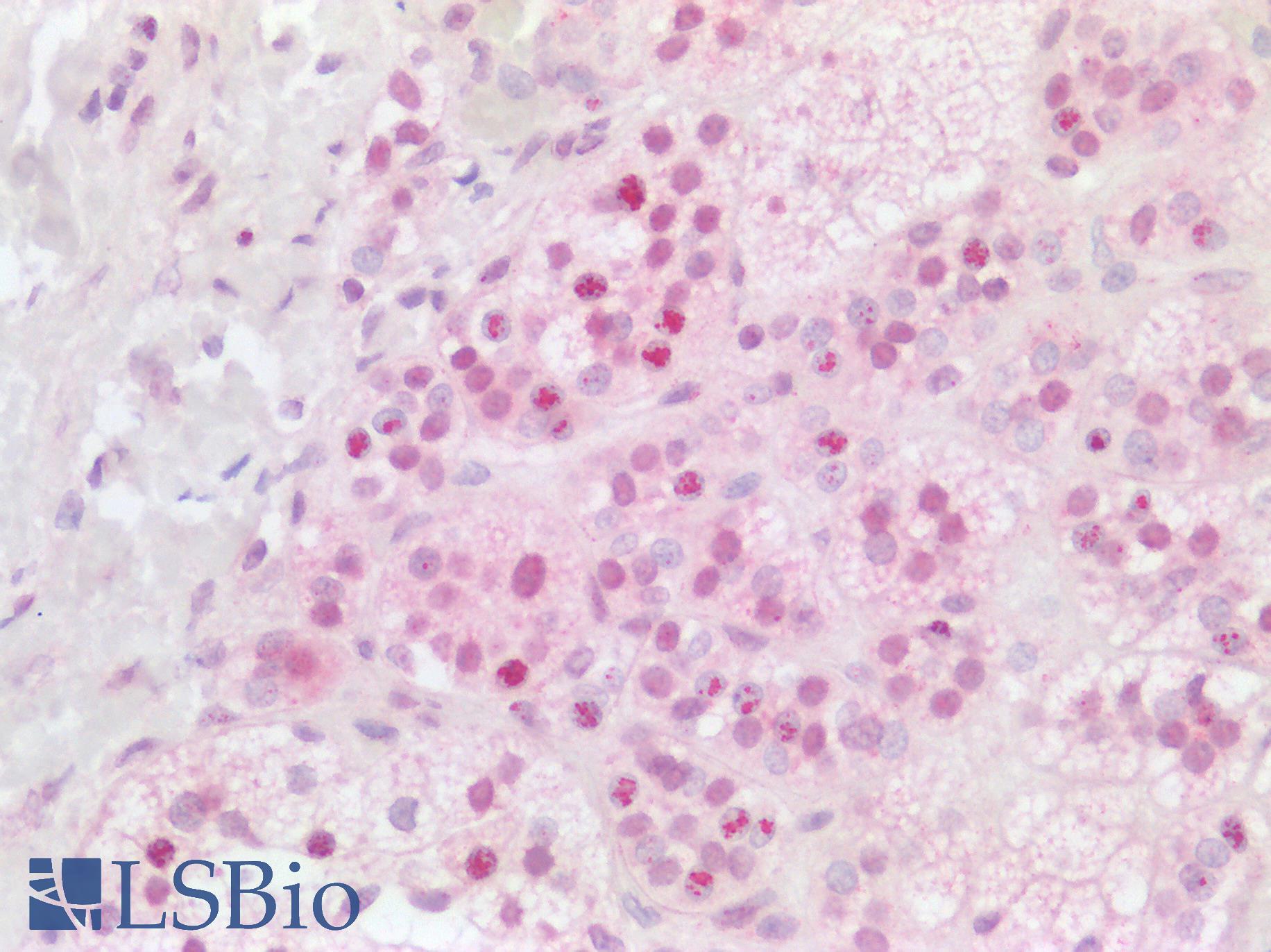 HES1 / HES-1 Antibody - Human Adrenal: Formalin-Fixed, Paraffin-Embedded (FFPE)