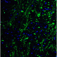 HES5 Antibody - Immunofluorescence of HES5 in mouse brain tissue with HES5 Antibodyat 20 µg/mL.