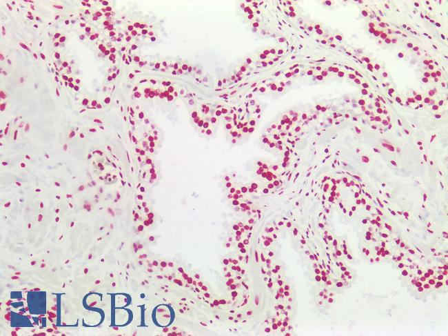 HES5 Antibody - Human Prostate: Formalin-Fixed, Paraffin-Embedded (FFPE)
