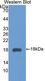 HEXB Antibody - Western Blot; Sample: Recombinant protein.
