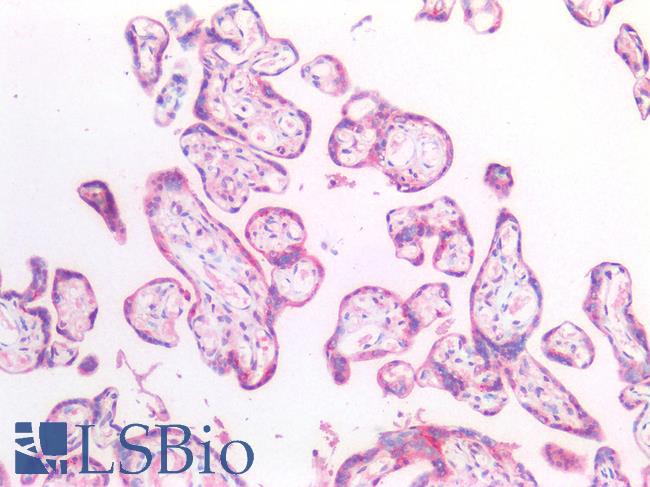HEXB Antibody - Human Placenta: Formalin-Fixed, Paraffin-Embedded (FFPE)