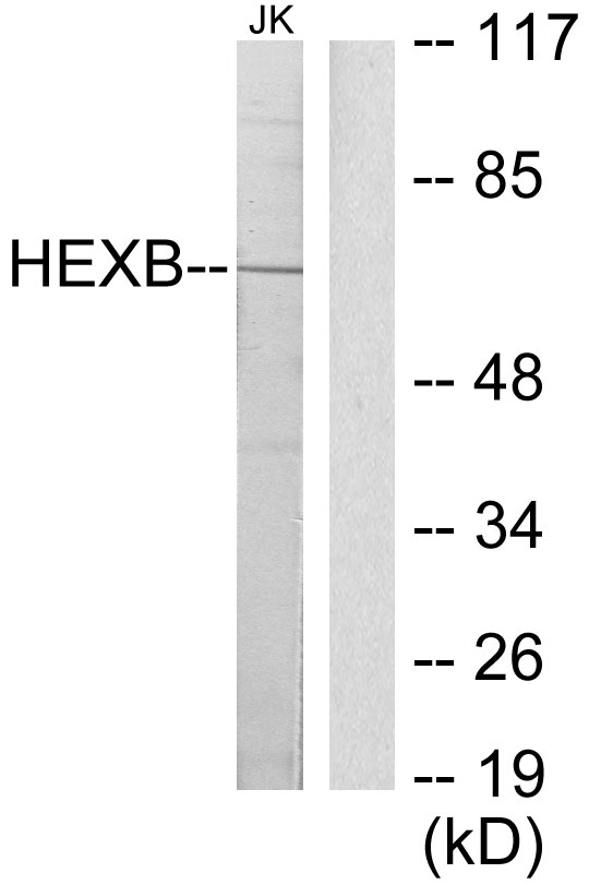 HEXB Antibody - Western blot analysis of lysates from Jurkat cells, using HEXB Antibody. The lane on the right is blocked with the synthesized peptide.