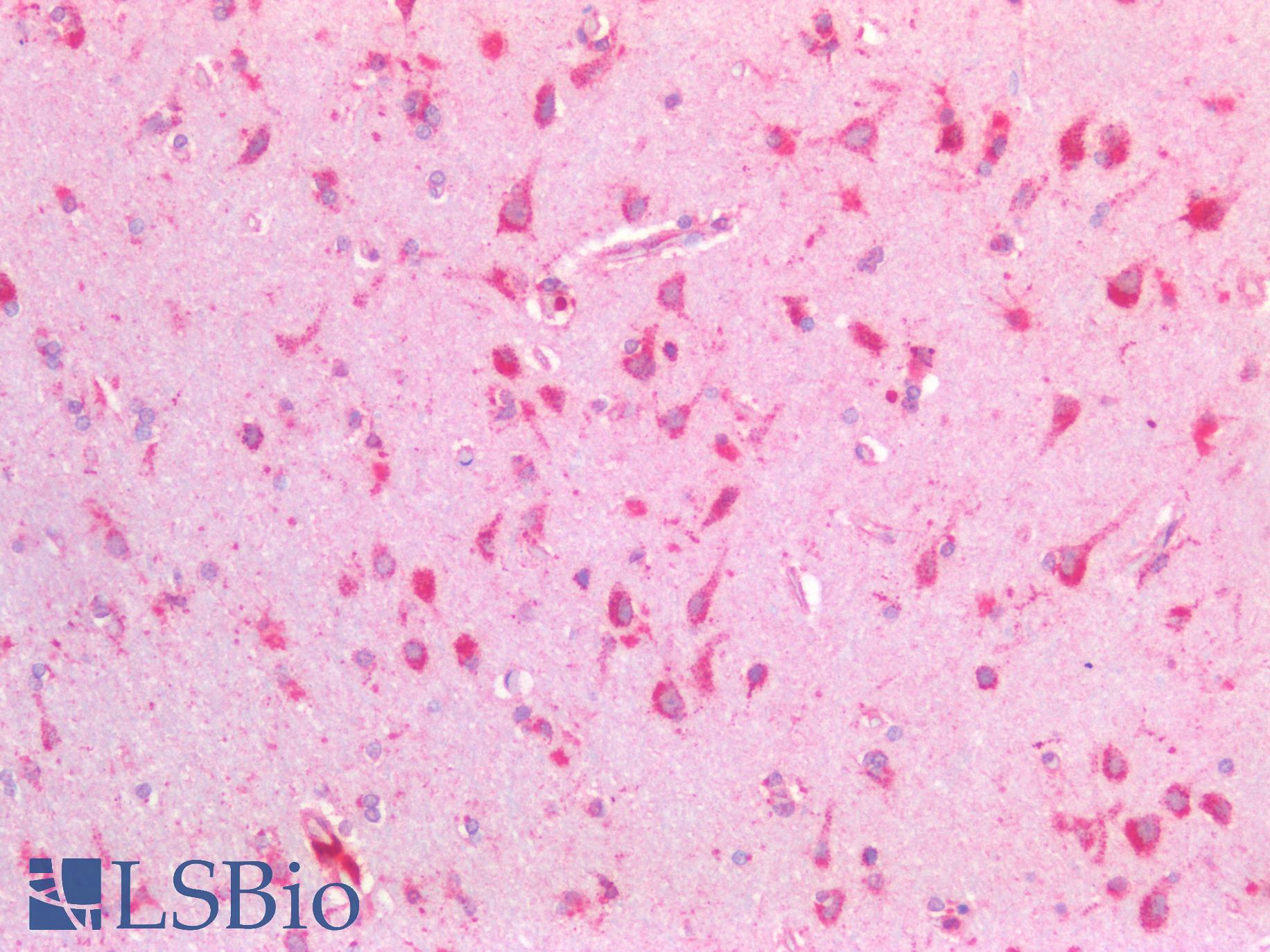 HEXB Antibody - Human Brain, Cortex: Formalin-Fixed, Paraffin-Embedded (FFPE)