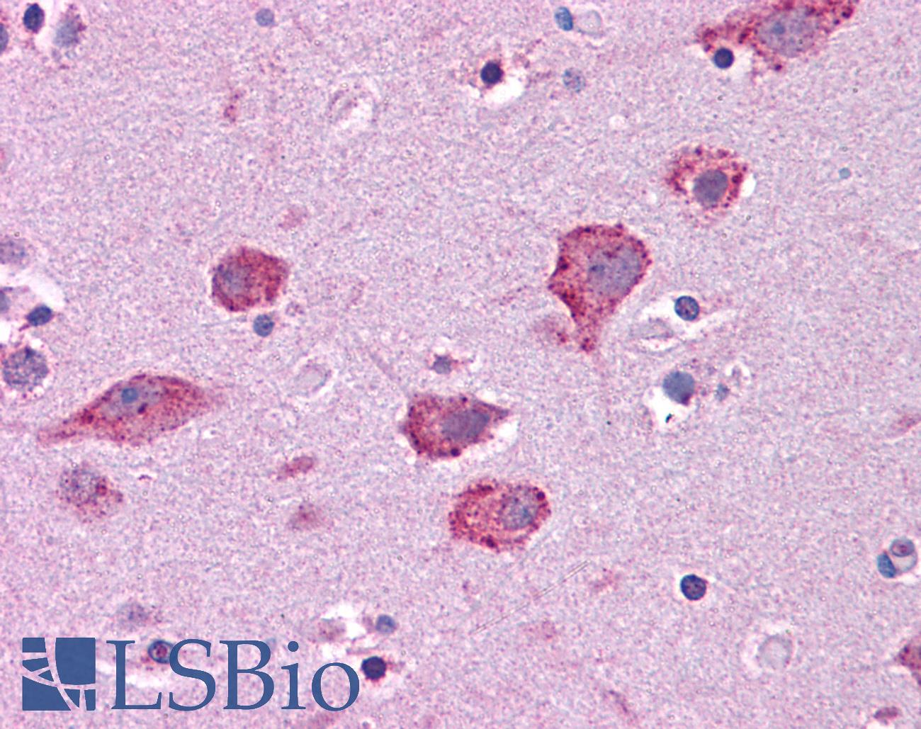 HGF / Hepatocyte Growth Factor Antibody - Anti-HGF antibody IHC of human brain, cortex. Immunohistochemistry of formalin-fixed, paraffin-embedded tissue after heat-induced antigen retrieval. Antibody concentration 5 ug/ml.  This image was taken for the unconjugated form of this product. Other forms have not been tested.