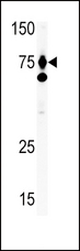 HGF / Hepatocyte Growth Factor Antibody - The anti-HGF antibody is used in Western blot to detect HGF in Ramos tissue lysate. HGF (arrow) was detected using the purified antibody.