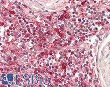 HLA-DRA Antibody - Human Spleen: Formalin-Fixed, Paraffin-Embedded (FFPE)