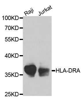 HLA-DRA Antibody - Western blot analysis of extracts of various cell lines, using HLA-DRA antibody at 1:1000 dilution. The secondary antibody used was an HRP Goat Anti-Rabbit IgG (H+L) at 1:10000 dilution. Lysates were loaded 25ug per lane and 3% nonfat dry milk in TBST was used for blocking.