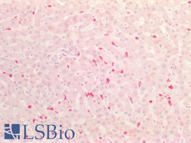 HNE / Neutrophil Elastase Antibody - Human Liver: Formalin-Fixed, Paraffin-Embedded (FFPE)