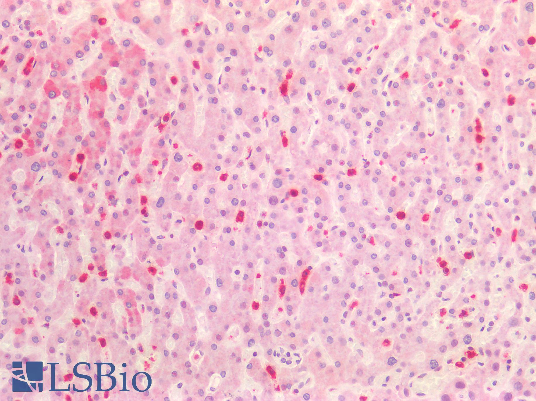 HNE / Neutrophil Elastase Antibody - Human Liver: Formalin-Fixed, Paraffin-Embedded (FFPE)