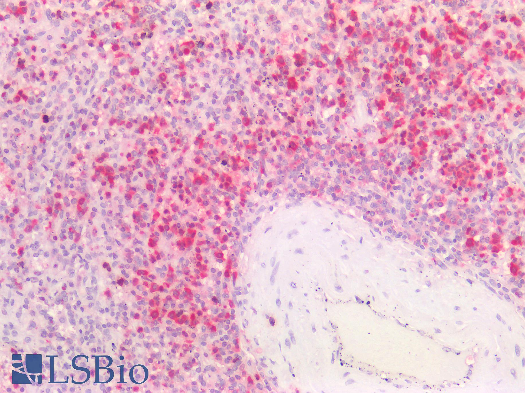 HNE / Neutrophil Elastase Antibody - Human Spleen: Formalin-Fixed, Paraffin-Embedded (FFPE)