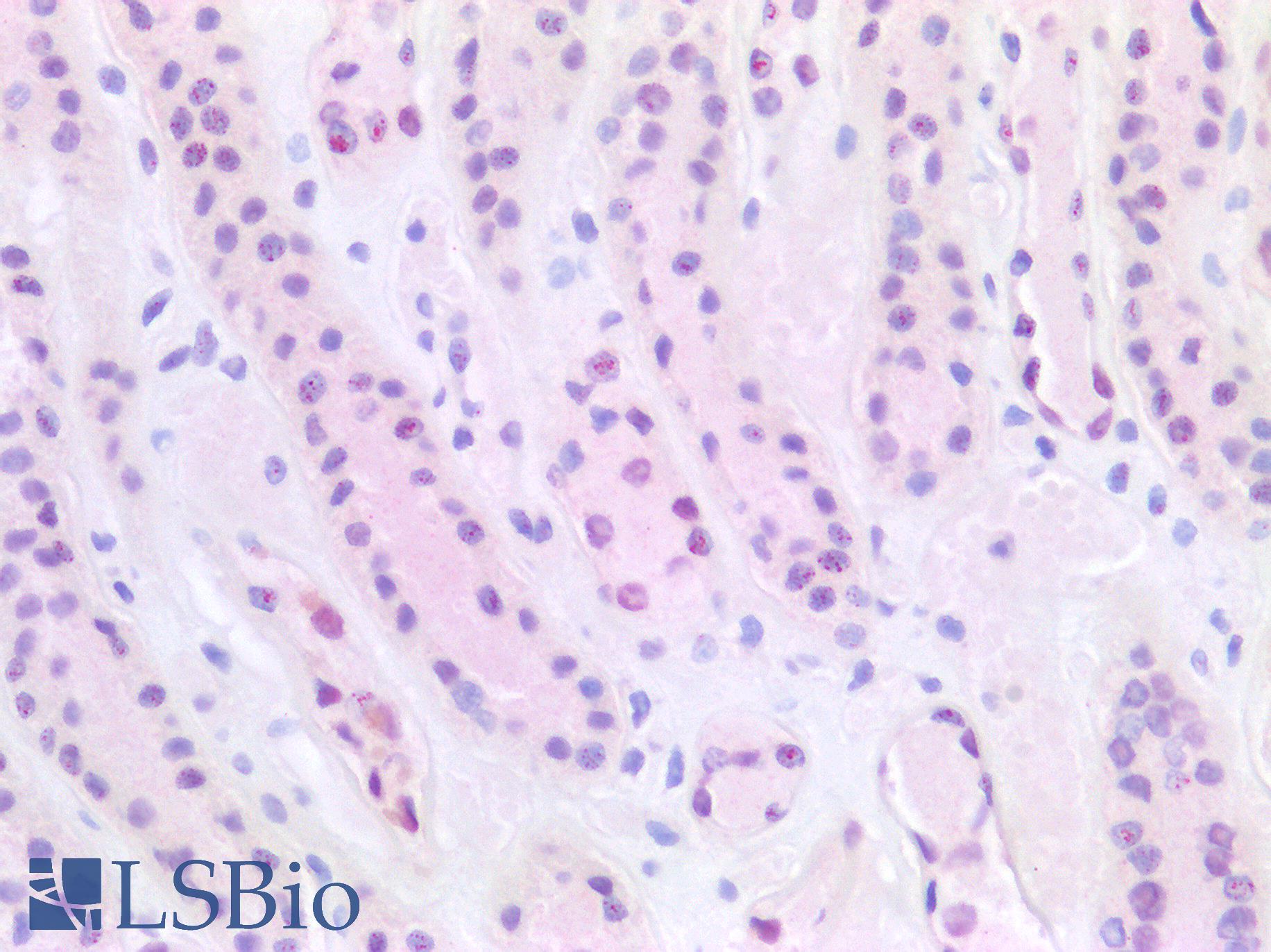 HNF1B / HNF1 Beta Antibody - Human Kidney: Formalin-Fixed, Paraffin-Embedded (FFPE)