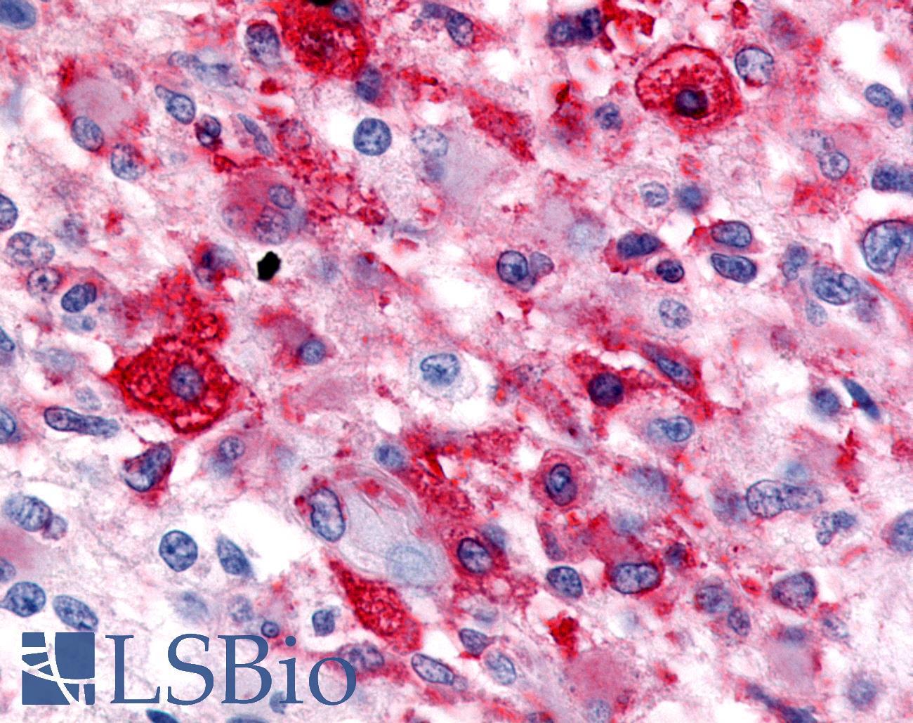 HNF4G / HNF4 Gamma Antibody - Brain, Glioblastoma