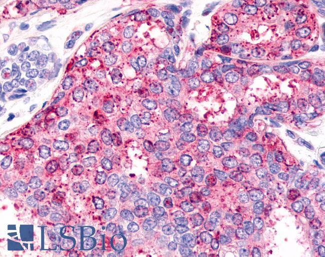 HNF4G / HNF4 Gamma Antibody - Breast carcinoma