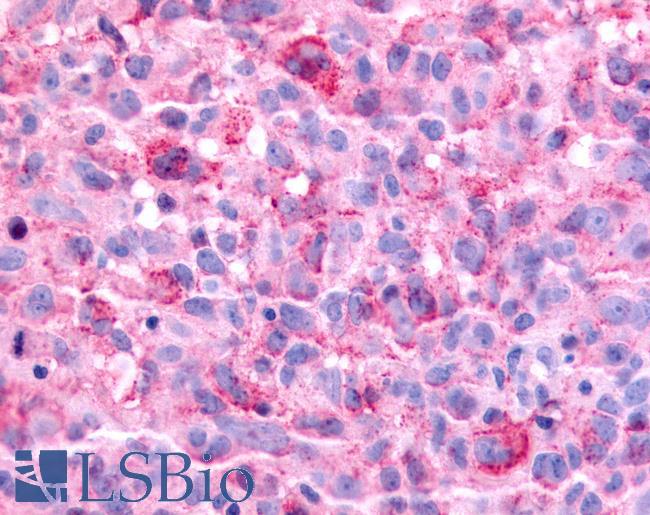 HNF4G / HNF4 Gamma Antibody - Brain, Glioblastoma