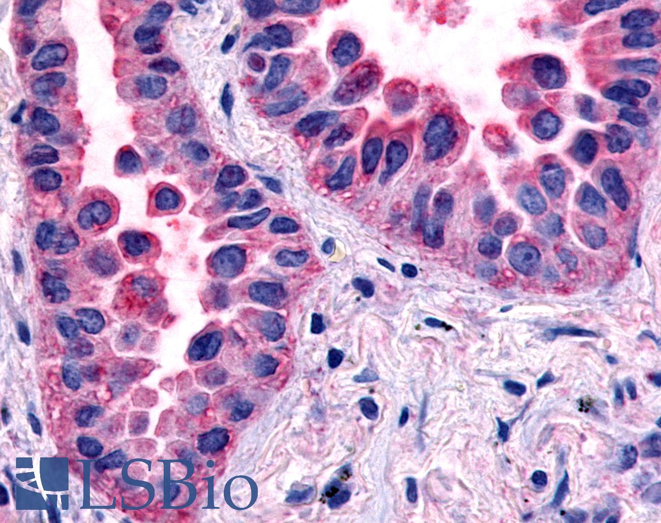 HNF4G / HNF4 Gamma Antibody - Lung, Non Small-Cell Carcinoma