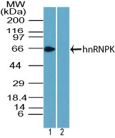 HNRNPK / hnRNP K Antibody - Western blot of hnRNPK in K562 cell lysate in the 1) absence and 2) presence of immunizing peptide using HNRNPK / hnRNP K Antibody at2 ug/ml. Goat anti-rabbit Ig HRP secondary antibody, and PicoTect ECL substrate solution, were used for this test.