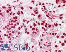 HNRNPK / hnRNP K Antibody - Anti-HnRNP K antibody IHC of human adrenal. Immunohistochemistry of formalin-fixed, paraffin-embedded tissue after heat-induced antigen retrieval. Antibody dilution 5-10 ug/ml.