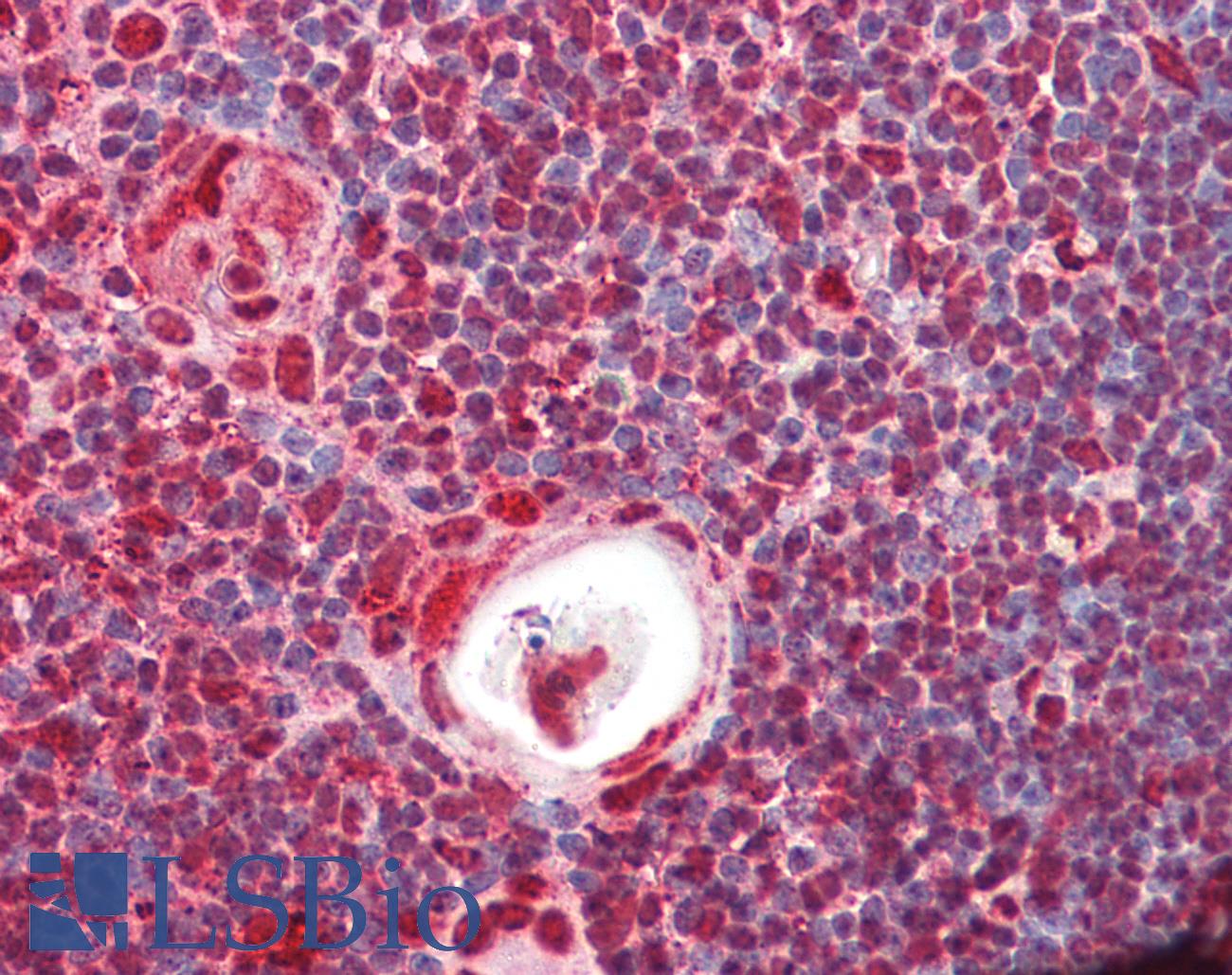 HNRNPK / hnRNP K Antibody - Anti-HnRNP K antibody IHC of human thymus. Immunohistochemistry of formalin-fixed, paraffin-embedded tissue after heat-induced antigen retrieval. Antibody dilution 5-10 ug/ml.