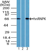 HNRNPK / hnRNP K Antibody - Western blot of hnRNPK in K562 cell lysate in the 1) absence and 2) presence of immunizing peptide and 3) NIH 3T3 cell lysate using HNRNPK / hnRNP K Antibody at 4 ug/ml and 2 ug/ml respectively. Goat anti-rabbit Ig HRP secondary antibody, and PicoTect ECL substrate solution, were used for this test.