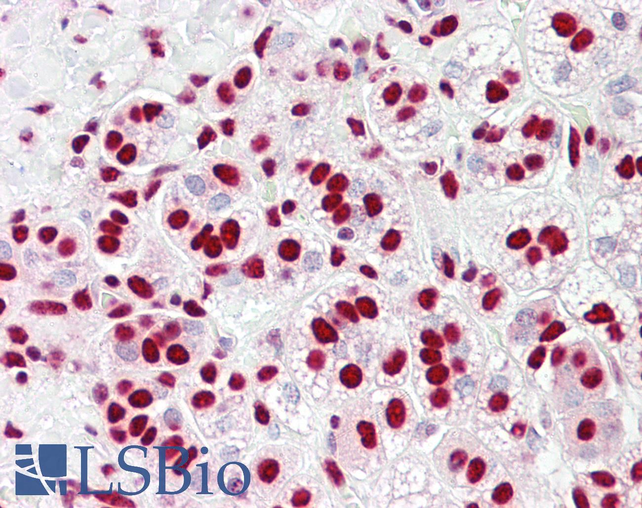 HNRNPK / hnRNP K Antibody - Anti-HnRNP K antibody IHC of human adrenal. Immunohistochemistry of formalin-fixed, paraffin-embedded tissue after heat-induced antigen retrieval. Antibody dilution 2-10 ug/ml.