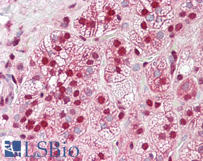 HNRNPK / hnRNP K Antibody - Anti-HnRNP K antibody IHC of human adrenal. Immunohistochemistry of formalin-fixed, paraffin-embedded tissue after heat-induced antigen retrieval. Antibody dilution 5-10 ug/ml.