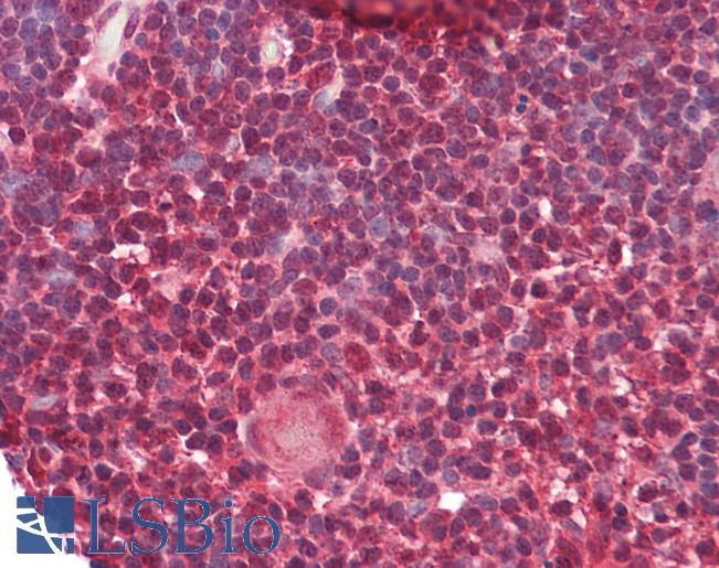 HNRNPK / hnRNP K Antibody - Anti-HnRNP K antibody IHC of human thymus. Immunohistochemistry of formalin-fixed, paraffin-embedded tissue after heat-induced antigen retrieval. Antibody dilution 5-10 ug/ml.