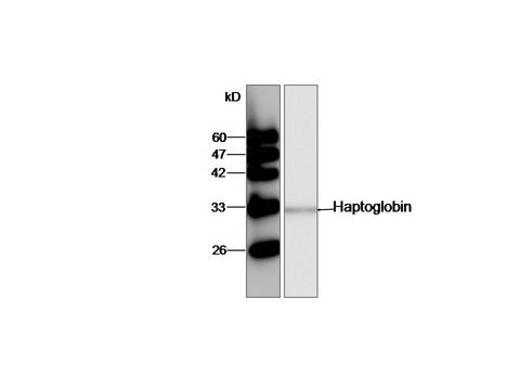 HP / Haptoglobin Antibody