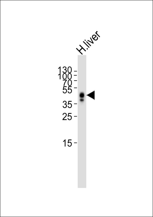 HP / Haptoglobin Antibody - Western blot of lysate from human liver tissue lysate, using HP Antibody. Antibody was diluted at 1:1000. A goat anti-rabbit IgG H&L (HRP) at 1:5000 dilution was used as the secondary antibody. Lysate at 35ug.