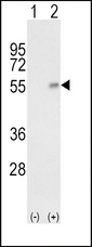 HP / Haptoglobin Antibody - Western blot of HP (arrow) using rabbit polyclonal HP Antibody. 293 cell lysates (2 ug/lane) either nontransfected (Lane 1) or transiently transfected with the HP gene (Lane 2).