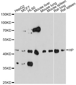HP / Haptoglobin Antibody - Western blot analysis of extracts of various cell lines, using HP antibody at 1:1000 dilution. The secondary antibody used was an HRP Goat Anti-Rabbit IgG (H+L) at 1:10000 dilution. Lysates were loaded 25ug per lane and 3% nonfat dry milk in TBST was used for blocking. An ECL Kit was used for detection and the exposure time was 90s.